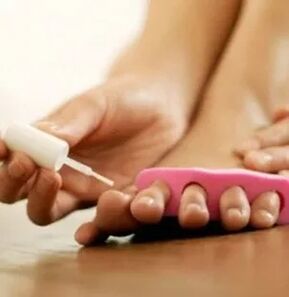 Aplicación de barniz terapéutico